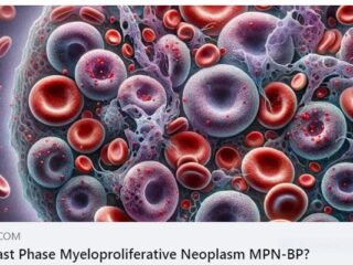 ระยะเฉียบพลัน ของ โรค MPN คืออะไร?