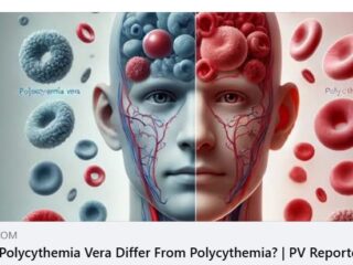 โรคเลือดข้น (Polycythemia Vera) แตกต่างจาก ภาวะเม็ดเลือดแดงมากผิดปกติ (Polycythemia) อย่างไร?