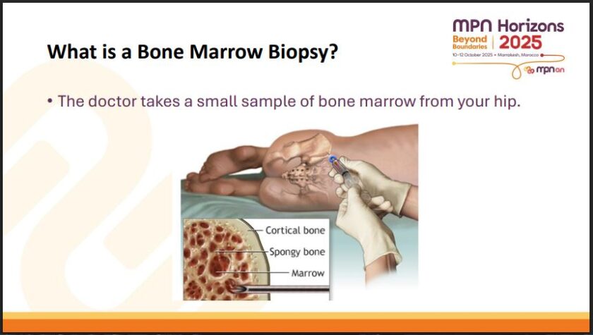สรุปหัวข้อสำคัญของการประชุม MPN Horizons Conference 2025 – ตอน 2