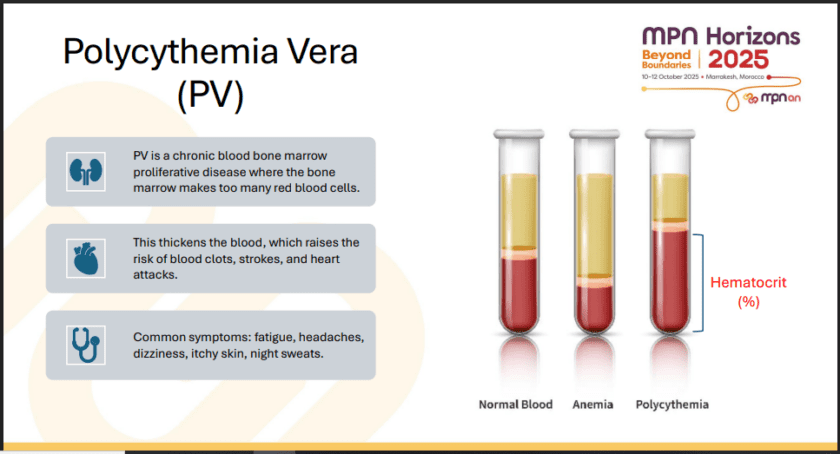 สรุปหัวข้อสำคัญของการประชุม MPN Horizons Conference 2025 – ตอน 5